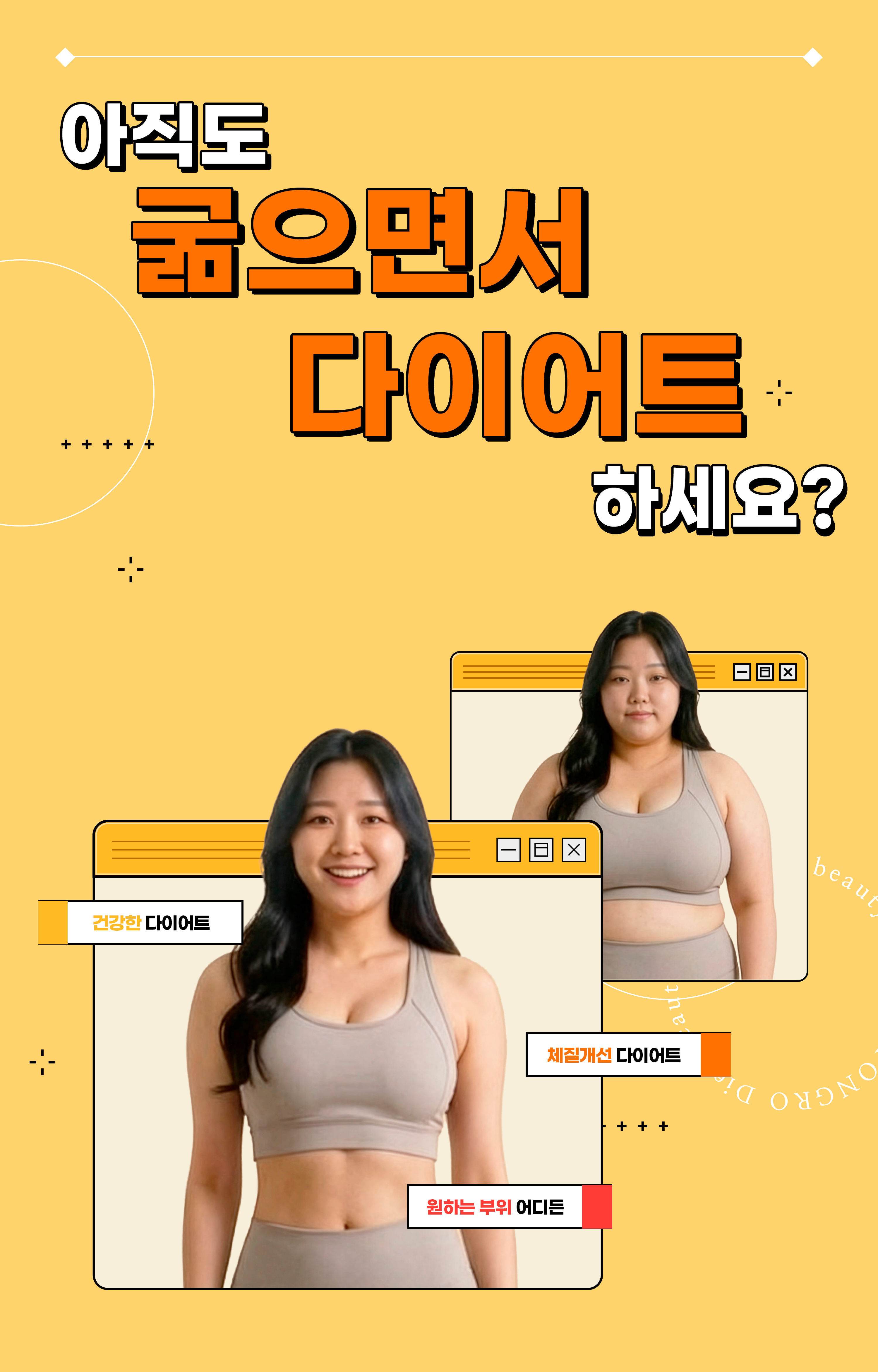모발이식 상담 안내 이미지
